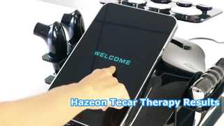 جهاز العلاج الطبيعي وإعادة التأهيل RL-W20 Hazeon Tecar - جهاز متقدم للعلاج الطبيعي وإعادة التأهيل بتردد 448 كيلو هرتز