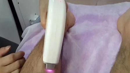 آلة إزالة الشعر بالليزر ديود 808 نانومتر مع طاقة 1-50 أمبير وعرض نبضة 1-400 مللي ثانية لـ 6 أنواع بشرة